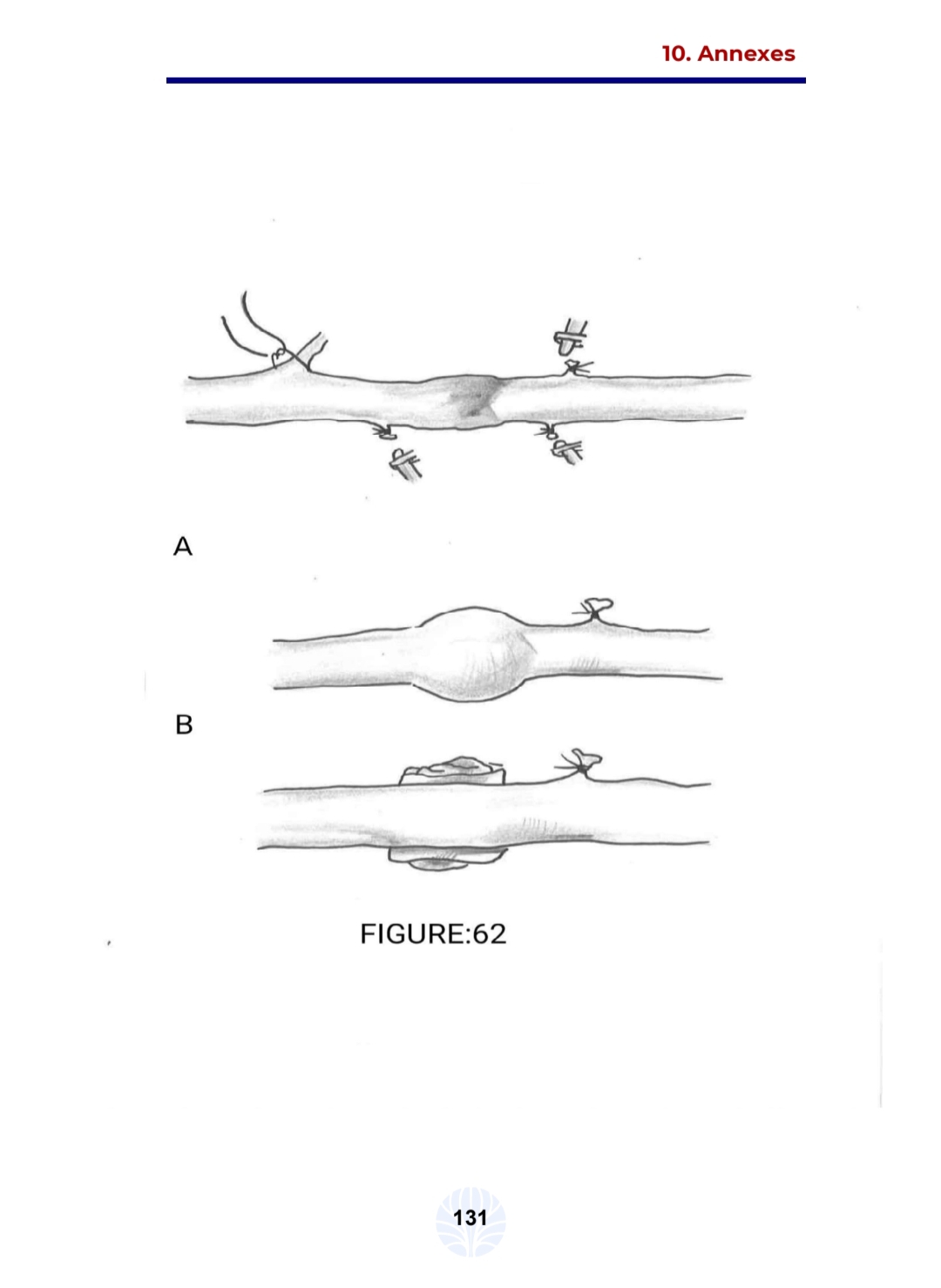 Les principes de la chirurgie vasculaire - الصورة 11