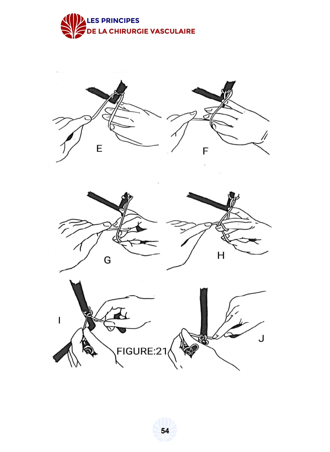 Les principes de la chirurgie vasculaire - الصورة 8