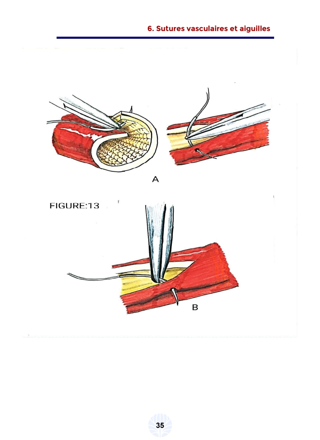 Les principes de la chirurgie vasculaire - الصورة 15