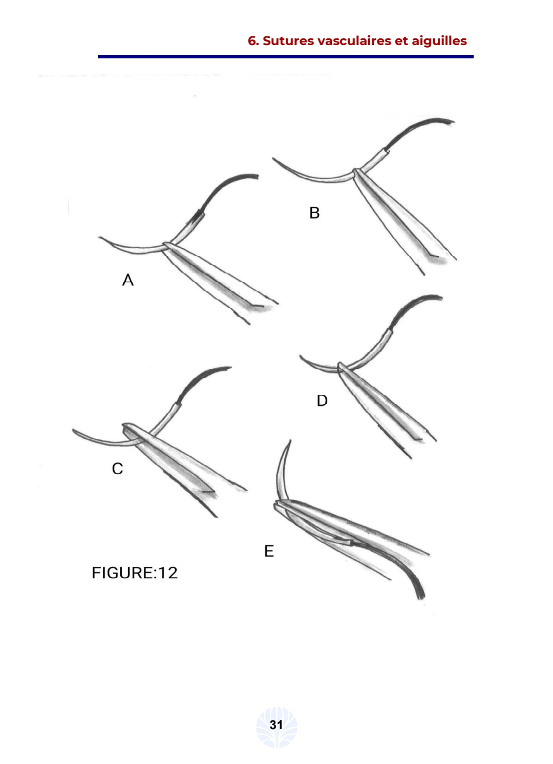 Les principes de la chirurgie vasculaire - الصورة 10