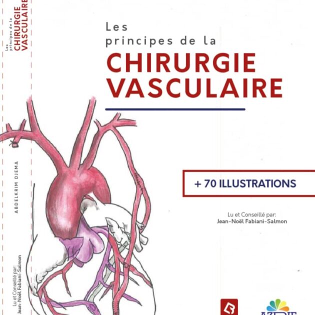 Les principes de la chirurgie vasculaire
